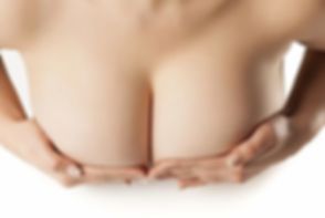 mamoplastia-redutora-em-Marab%C3%83%C2%A