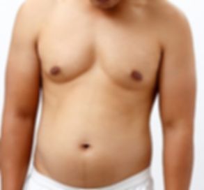 mucio_leao_procedimentos_cirurgicos_gine